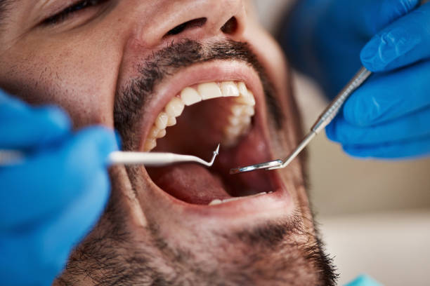 Best Mobile Emergency Dentist in Port Royal, SC