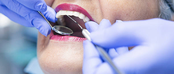 Best Emergency Dental Extractions in Port Royal, SC